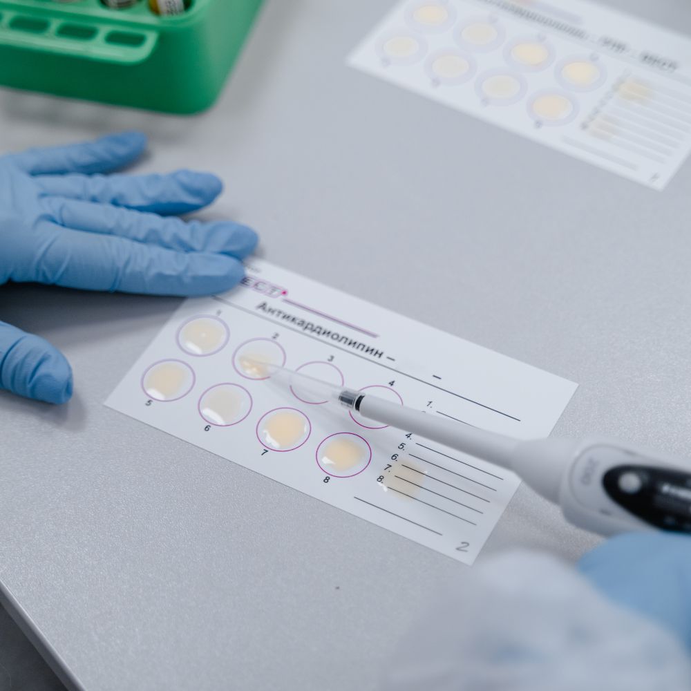 Urine Test Strips 10-Parameter (100s) – image 3