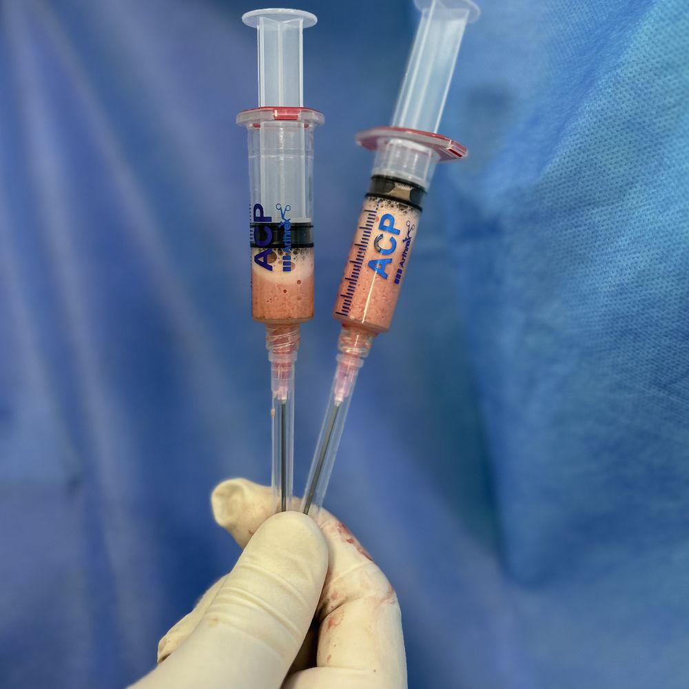 Disposable Syringes 5ml (10s)